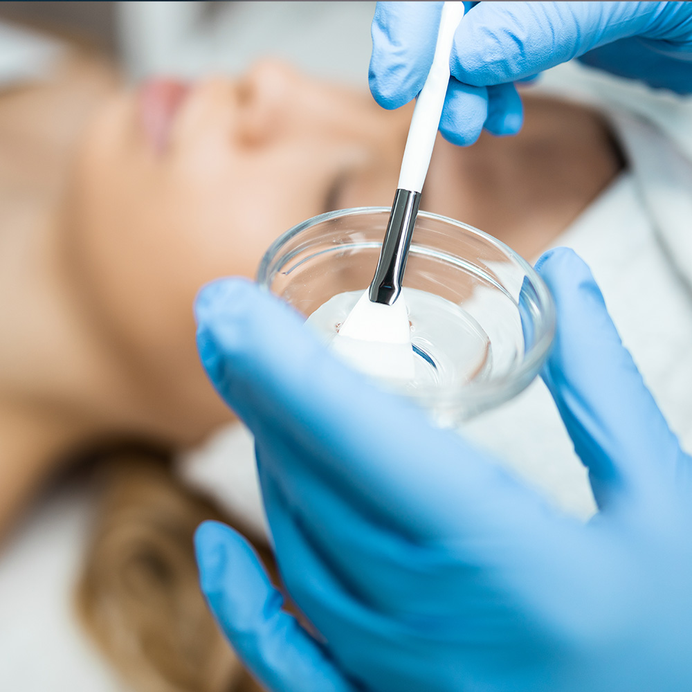 Closeup Of Chemical Peel