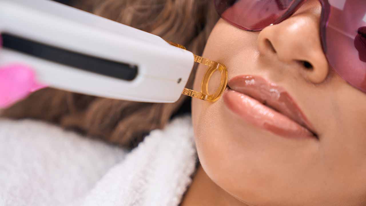Laser Hair Removal