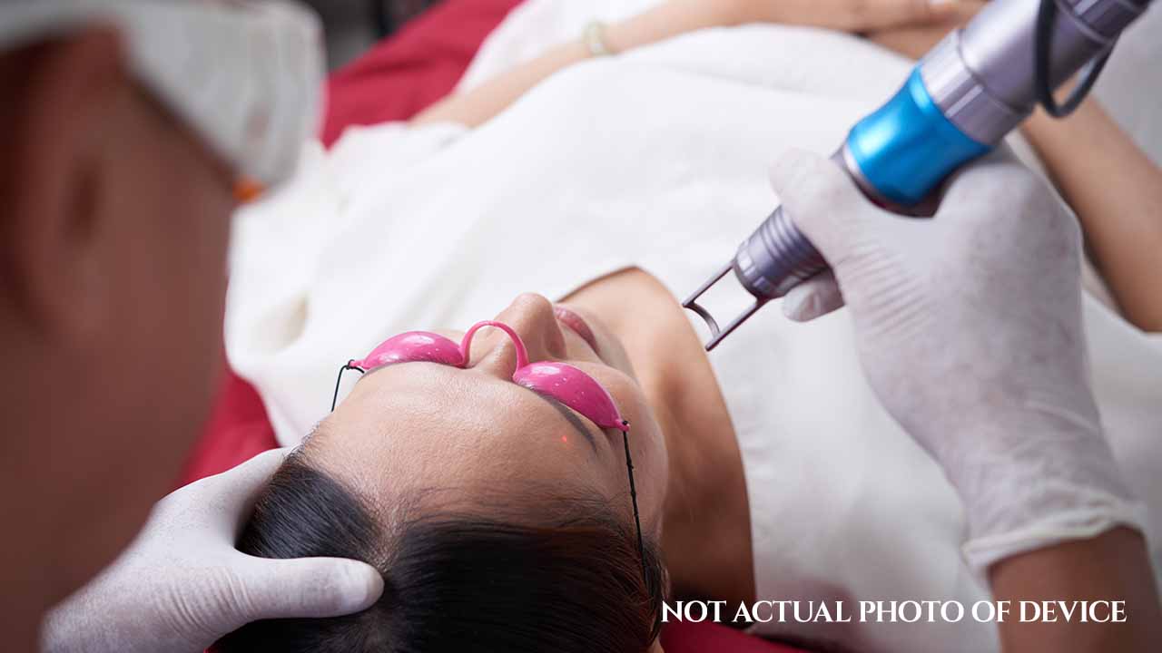 Skin Resurfacing Laser